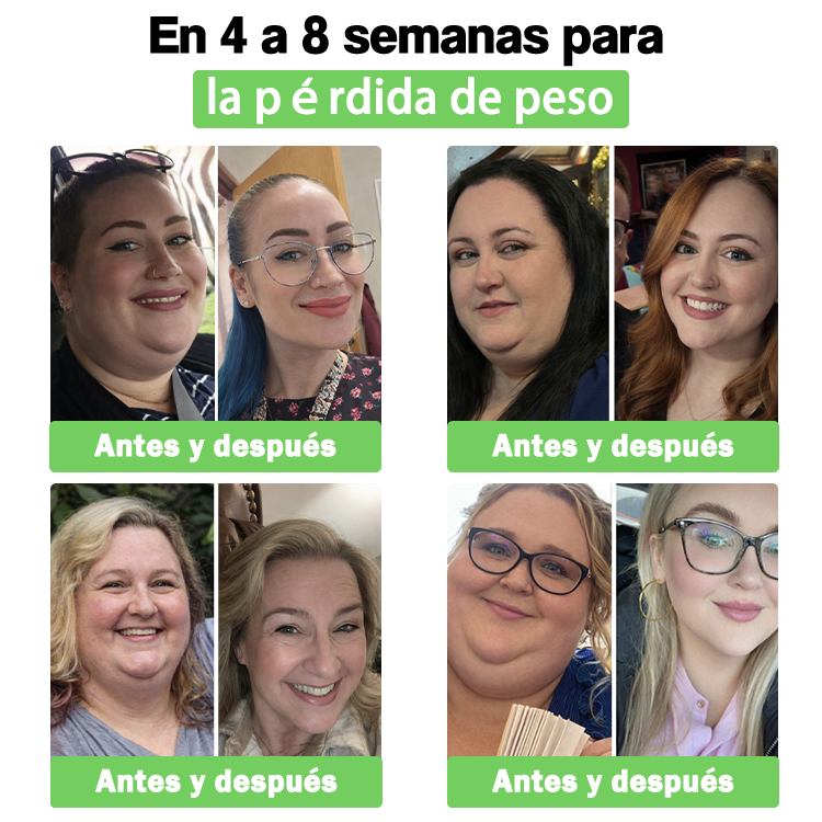ES.𝑷𝒂𝒓𝒄𝒉𝒆 𝑵𝒂𝒏𝒐 𝒅𝒆 𝑴𝒊𝒄𝒓𝒐𝒂𝒈𝒖𝒋𝒂𝒔 𝑨𝑴𝒁𝑲𝑬𝑬𝑷® 𝑵𝑨𝑫+ 𝑴𝒐𝒓𝒊𝒏𝒈𝒂 𝑩𝒆𝒓𝒃𝒆𝒓𝒊𝒏𝒆 𝑨𝑴𝑷𝑲 𝑺𝒖𝒑𝒑𝒐𝒓𝒕 (𝑺𝒐𝒍𝒐 𝑼𝒏𝒂 𝑽𝒆𝒛 𝒂𝒍 𝑫í𝒂, 𝑪𝒂𝒎𝒃𝒊𝒐𝒔 𝑽𝒊𝒔𝒊𝒃𝒍𝒆𝒔 𝒆𝒏 7 𝑫í𝒂𝒔) 𝑭ó𝒓𝒎𝒖𝒍𝒂 ✅ 𝑷𝒂𝒓𝒂 𝑨𝒑𝒐𝒚𝒂𝒓 𝑴𝒆𝒕𝒂𝒃𝒐𝒍𝒊𝒔𝒎𝒐, 𝑷𝒆𝒔𝒐, 𝑪𝒐𝒓𝒂𝒛ó𝒏, 𝑶𝒃𝒆𝒔𝒊𝒅𝒂𝒅, 𝑭𝒍𝒂𝒄𝒊𝒅𝒆𝒛, 𝑫𝒊𝒂𝒃𝒆𝒕𝒆𝒔, 𝑨𝒑𝒏𝒆𝒂 𝒅𝒆𝒍 𝑺𝒖𝒆ñ𝒐, 𝑨𝒓𝒕𝒊𝒄𝒖𝒍𝒂𝒄𝒊𝒐𝒏𝒆𝒔 𝒚 𝑴á𝒔