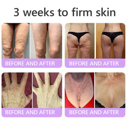 𝐇𝐈𝐒𝐊𝐈𝐍® 𝐏𝐃𝐑𝐍 𝐌𝐮𝐥𝐭𝐢-𝐏𝐞𝐩𝐭𝐢𝐝𝐞 𝐌𝐚𝐬𝐬𝐚𝐠𝐢𝐧𝐠 𝐁𝐨𝐝𝐲 𝐑𝐨𝐥𝐥𝐞𝐫 𝐂𝐫𝐞𝐚𝐦- Anti-aging, Hydrating, Skin Firming & Lifting, Skin Repair, Even Tone, Acne and Dark Spot Treatment, Wart and Mole Removal, and Psoriasis Relief.